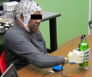 prosthetic hand