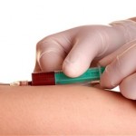blood-test